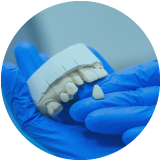 Rehabilitación Oral y Estética
